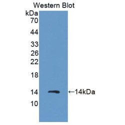 Protein S100-A8 / CAGA (S100A8) Antibody