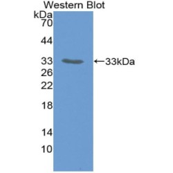 Prostaglandin G/H Synthase 1 (PTGS1) Antibody