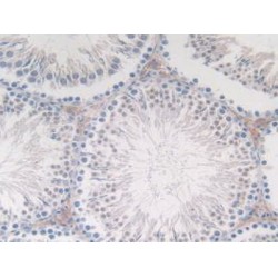 Procalcitonin (PCT) Antibody