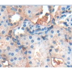 Smoothelin (SMTN) Antibody