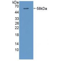 Calcium/Calmodulin Dependent Protein Kinase II Alpha (CAMK2a) Antibody