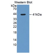 Western blot analysis of recombinant Rat HSD11b2 Protein.