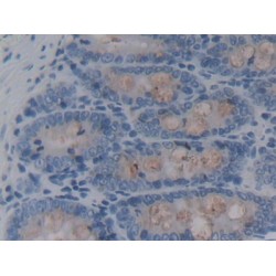 Regenerating Islet Derived Protein 3 Beta (REG3b) Antibody