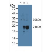 Western blot analysis of (1) Rat Serum, (2) Rat Heart Tissue and (3) Rat Kidney Tissue.