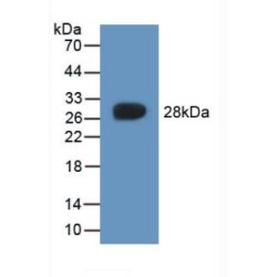 Cytoglobin (CYGB) Antibody
