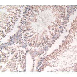 Cytoglobin (CYGB) Antibody
