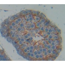 Cytochrome P450 Oxidoreductase (POR) Antibody
