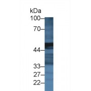Western blot analysis of Mouse Pancreas lysate, using Rat CPA2 Antibody (2 µg/ml) and HRP-conjugated Goat Anti-Rabbit antibody (<a href="https://www.abbexa.com/index.php?route=product/search&amp;search=abx400043" target="_blank">abx400043</a>, 0.2 µg/ml).