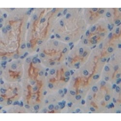 Interleukin 23 Receptor (IL23R) Antibody