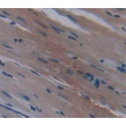 Meteorin (METRN) Antibody