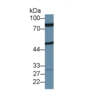 Western blot analysis of Rat Placenta lysate, using Rat ZP2 Antibody (1 µg/ml) and HRP-conjugated Goat Anti-Rabbit antibody (<a href="https://www.abbexa.com/index.php?route=product/search&amp;search=abx400043" target="_blank">abx400043</a>, 0.2 µg/ml).