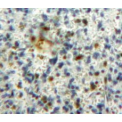 Granulocyte-Macrophage Colony-Stimulating Factor (CSF2) Antibody