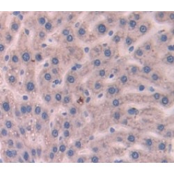 Protein AMBP (AMBP) Antibody