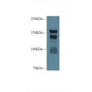 Western blot analysis of Rat Serum, using Rat THBS1 Antibody (1 µg/ml) and HRP-conjugated Goat Anti-Rabbit antibody (<a href="https://www.abbexa.com/index.php?route=product/search&amp;search=abx400043" target="_blank">abx400043</a>, 0.2 µg/ml).