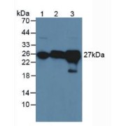 Western blot analysis of (1) Rat Serum, (2) Rat Brain Tissue and (3) Rat Liver Tissue.