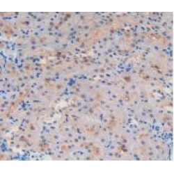 Glutathione S Transferase Alpha 4 (GSTa4) Antibody