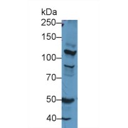 abx130177