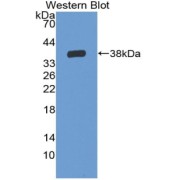 abx130195