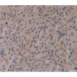 Cyclin Dependent Kinase 2 (CDK2) Antibody