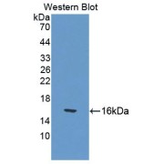Western blot analysis of the recombinant protein.