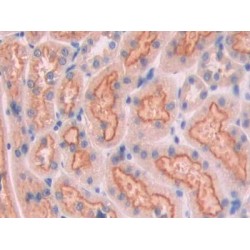 Cubilin (CUBN) Antibody