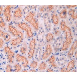 Cubilin (CUBN) Antibody