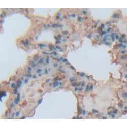 Peroxiredoxin 6 (PRDX6) Antibody