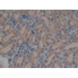 N-Acetylgalactosamine-6-Sulfatase (GAS) Antibody