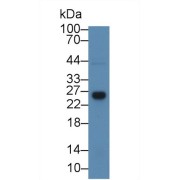 Western blot analysis of Rat Liver lysate, using Rat GSTt1 Antibody (3 µg/ml) and HRP-conjugated Goat Anti-Rabbit antibody (<a href="https://www.abbexa.com/index.php?route=product/search&amp;search=abx400043" target="_blank">abx400043</a>, 0.2 µg/ml).