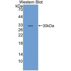 Glutathione S Transferase Theta 1 (GSTt1) Antibody