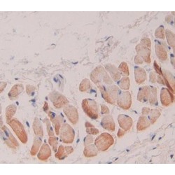 Glutathione S Transferase Theta 1 (GSTt1) Antibody