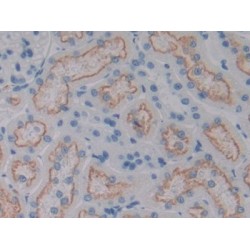 Cluster of Differentiation 320 (CD320) Antibody