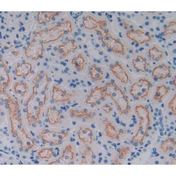 Cluster of Differentiation 320 (CD320) Antibody
