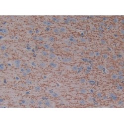 Cytochrome P450 7A1 (CYP7A1) Antibody