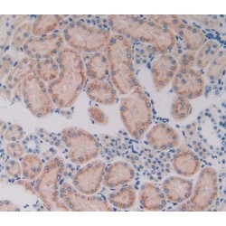 Cytochrome P450 7A1 (CYP7A1) Antibody