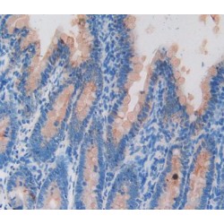 Keratin, Type I Cytoskeletal 20 (KRT20) Antibody