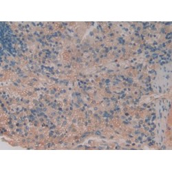 Tumor Necrosis Factor Receptor Superfamily Member 1B / CD120b (TNFRSF1B) Antibody