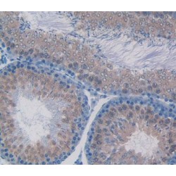 Tumor Necrosis Factor Receptor Superfamily Member 1B / CD120b (TNFRSF1B) Antibody