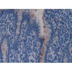 Regenerating Islet Derived Protein 4 (REG4) Antibody