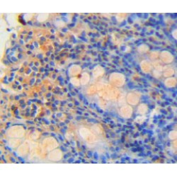 Regenerating Islet Derived Protein 4 (REG4) Antibody