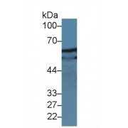 Western blot analysis of Human Jurkat cell lysate, using Rat Pax Antibody (5 µg/ml) and HRP-conjugated Goat Anti-Rabbit antibody (<a href="https://www.abbexa.com/index.php?route=product/search&amp;search=abx400043" target="_blank">abx400043</a>, 0.2 µg/ml).