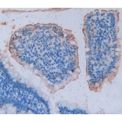 Angiotensin I Converting Enzyme 2 (ACE2) Antibody