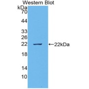Western blot analysis of the recombinant protein.