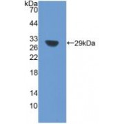 Western blot analysis of recombinant Rat SIRT1 Protein.