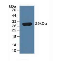 Interferon-Induced GTP-Binding Protein Mx1 (MX1) Antibody