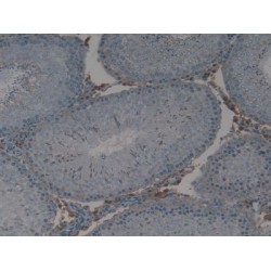 Interferon-Induced GTP-Binding Protein Mx1 (MX1) Antibody