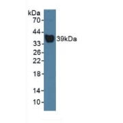 Western blot analysis of Rat Serum.
