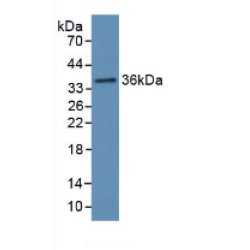 Haptoglobin Precursor / Zonulin (HP) Antibody