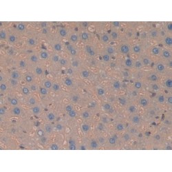 Haptoglobin Precursor / Zonulin (HP) Antibody