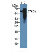Western blot analysis of (1) Rat Serum and (2) Rat Brain Tissue.